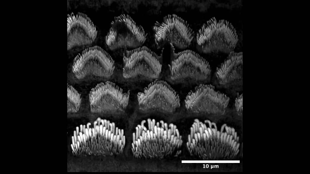 Sensory hair cells of the mouse inner ear stained with phalloidin to highlight actin-rich structures called stereocilia, which are arranged in bundles forming the mechanosensory organelle of the inner ear sensory cells. Three rows of outer hair cells (top) and a single row of inner hair cells (bottom) are visible, illustrating the precise cellular organization required for sound detection. Photo courtesy of Dr. Angela Ballesteros.