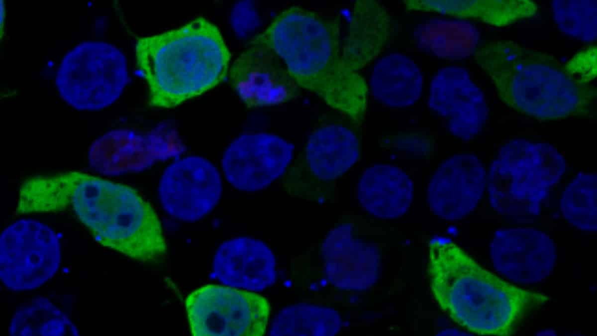Cell Mutation Mt Sinai