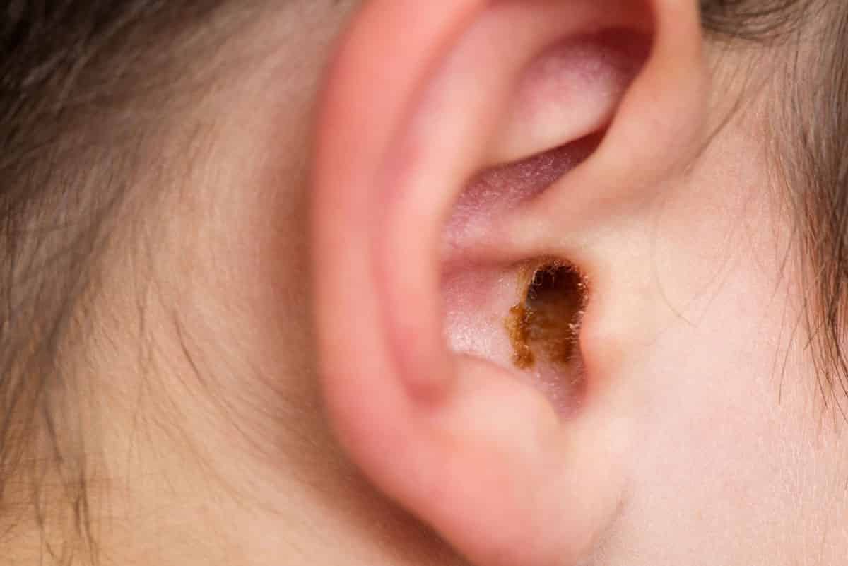 Earwax