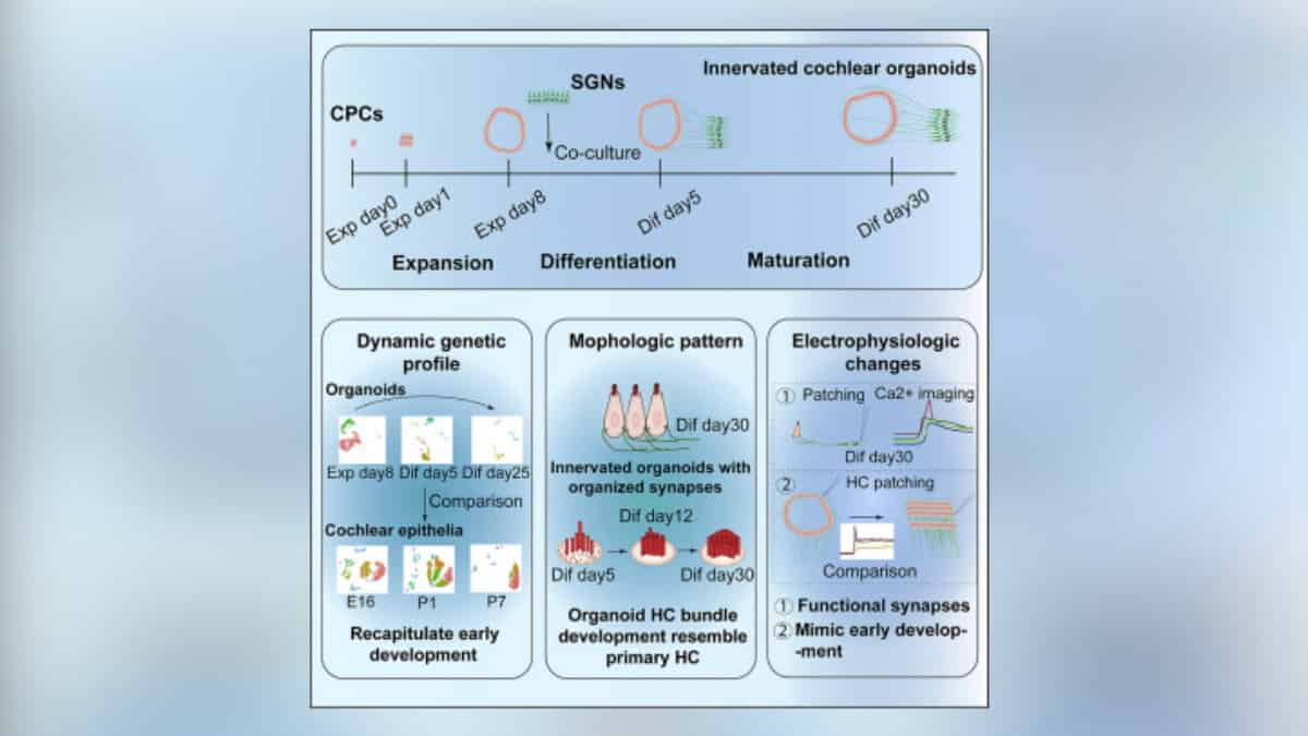 Cochlear Organoids Xia Et Al 0123