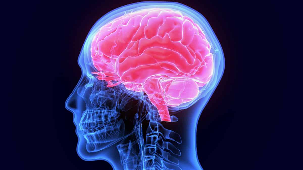 Brain Scan Of Head Mri