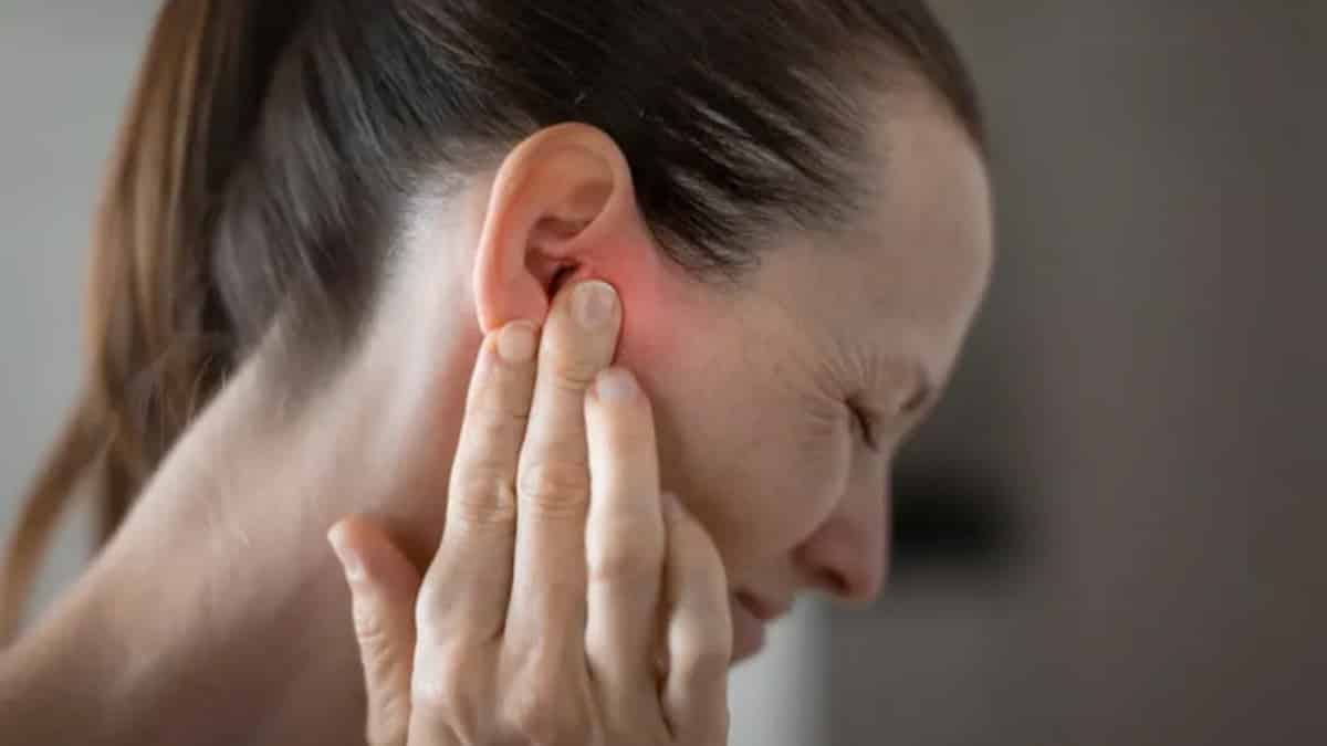 Tinnitus Aru Study