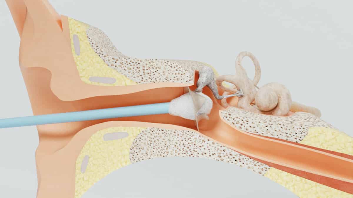 Hearing Loss Causes